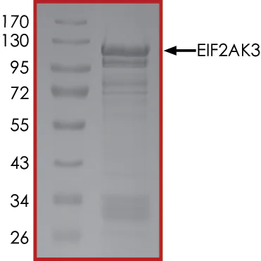 SDS-PAGE - Recombinant human PERK protein (AB101115)