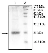 SDS-PAGE - Recombinant Human Peroxiredoxin 1/PAG (mutated K197D) protein (AB95476)
