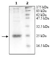 SDS-PAGE - Recombinant Human Peroxiredoxin 1/PAG (mutated K197D) protein (His tag N-Terminus) (AB95476)