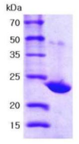 Recombinant human Peroxiredoxin 1/PAG protein