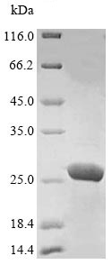 SDS-PAGE - Recombinant Human Peroxiredoxin 1/PAG protein (His tag) (AB241454), expandable thumbnail