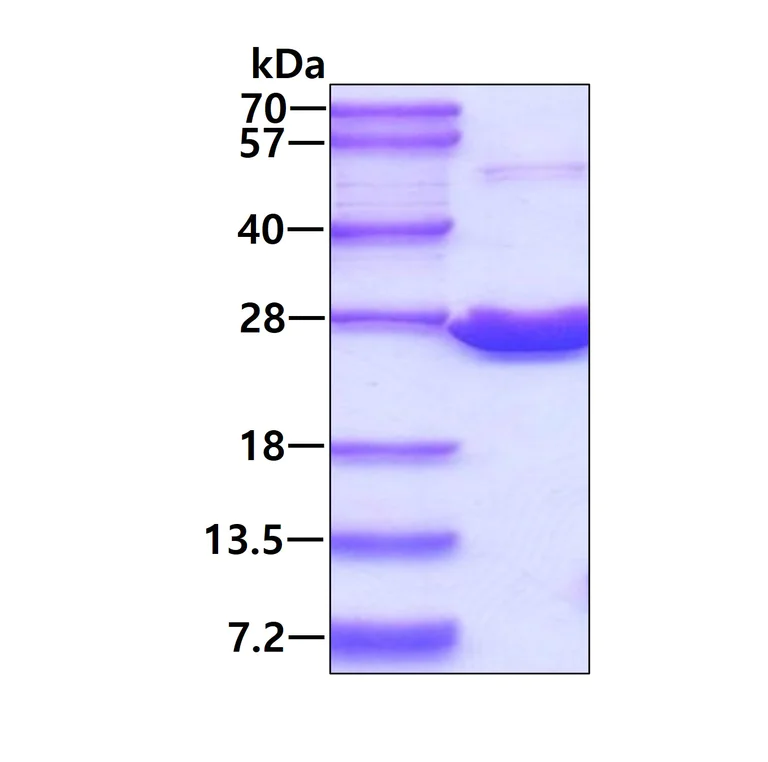 SDS-PAGE - Recombinant human Peroxiredoxin 1/PAG protein (His tag N-Terminus) (AB74172)