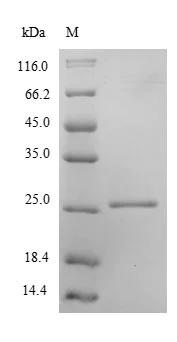 SDS-PAGE - Recombinant Human Peroxiredoxin 2/PRP protein (His tag) (AB236937)