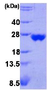 SDS-PAGE - Recombinant human Peroxiredoxin 3/PRDX3 protein (AB85559), expandable thumbnail