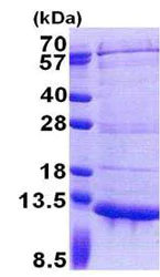 SDS-PAGE - Recombinant Human PET117 protein (His tag N-Terminus) (AB171710)