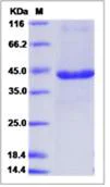 SDS-PAGE - Recombinant Human PEX11A protein (Fc Chimera) (AB276610)