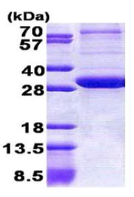 SDS-PAGE - Recombinant Human PEX26 protein (AB167869)