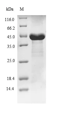 SDS-PAGE - Recombinant Human PFAS protein (Tagged) (AB236198)