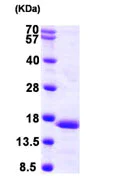 SDS-PAGE - Recombinant Human PFD6 protein (AB104644)