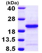 SDS-PAGE - Recombinant Human PFDN4 protein (AB103783), expandable thumbnail