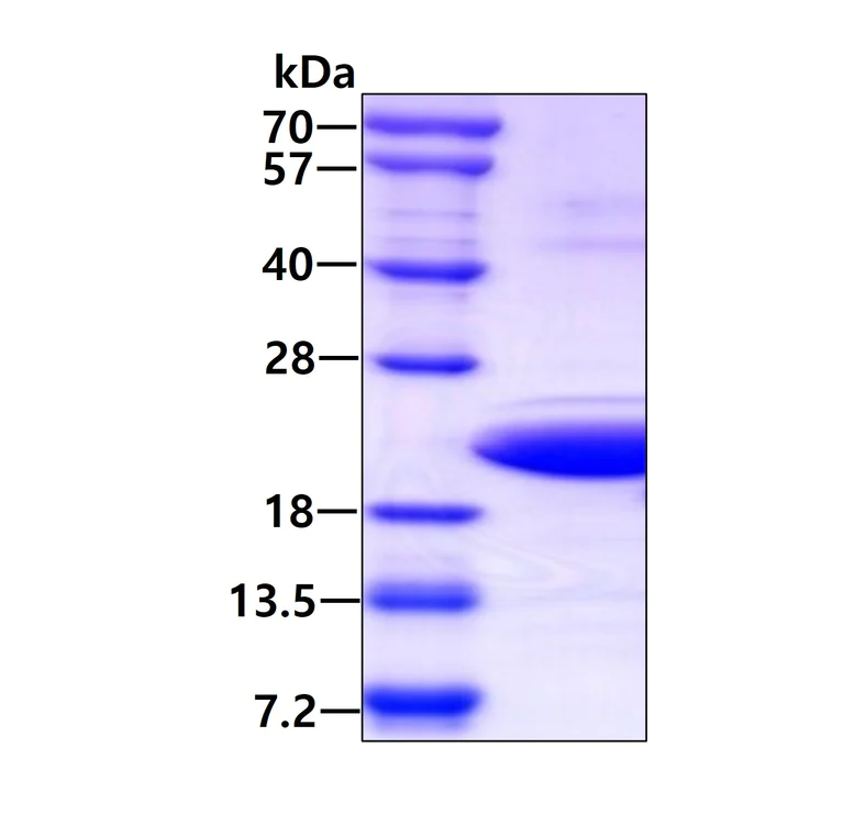 SDS-PAGE - Recombinant Human PFDN5 protein (AB113137)