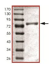 SDS-PAGE - Recombinant Human PFKFB1 protein (AB151800)