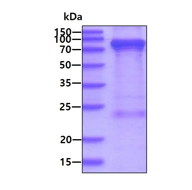 SDS-PAGE - Recombinant Human PFKM protein (His tag N-Terminus) (AB95304)
