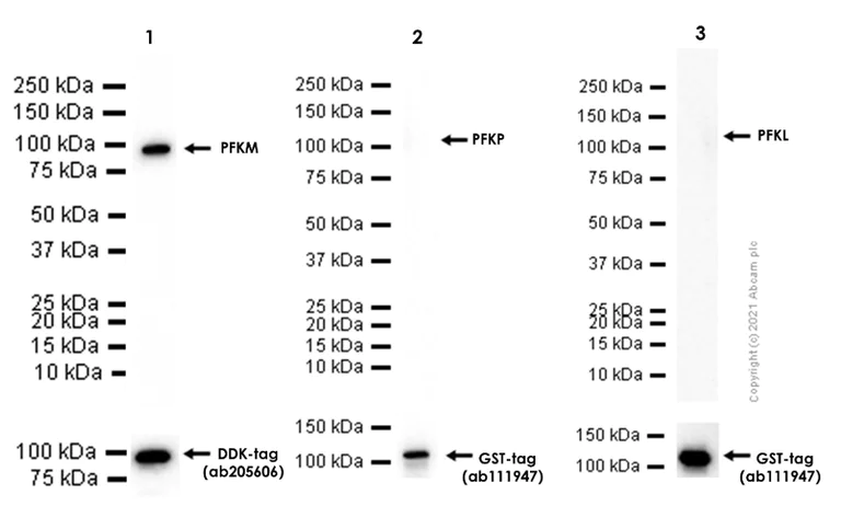 Western blot - Recombinant Human PFKP protein (GST tag N-Terminus) (AB132823)