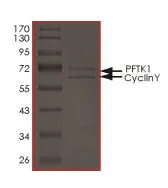 SDS-PAGE - Recombinant human PFTK1 (CDK14)/CyclinY protein (AB177576)