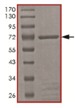 SDS-PAGE - Recombinant Human PFTK1 protein (AB167928)