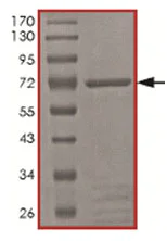 SDS-PAGE - Recombinant Human PFTK1 protein (AB167928)