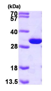 SDS-PAGE - Recombinant Human PGAM1 protein (His tag N-Terminus) (AB100885)