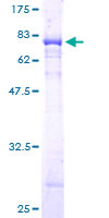 SDS-PAGE - Recombinant Human PGCP protein (AB160974), expandable thumbnail