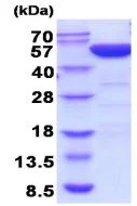 SDS-PAGE - Recombinant human PGD protein (His tag N-Terminus) (AB208326)
