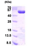 SDS-PAGE - Recombinant Human PGD protein (His tag N-Terminus) (AB93633)