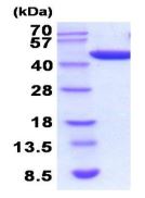 SDS-PAGE - Recombinant human PGK1 protein (AB211320), expandable thumbnail