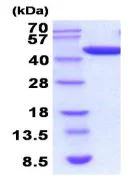SDS-PAGE - Recombinant human PGK1 protein (AB211320)
