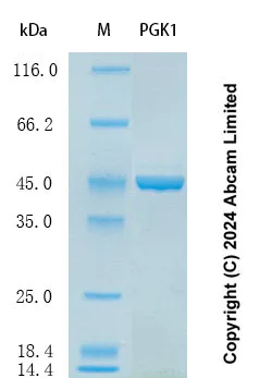 SDS-PAGE - Recombinant Human PGK1 Protein Standard (His tag) (AB323056)