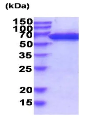 SDS-PAGE - Recombinant Human PGM1 protein (His tag N-Terminus) (AB207115)