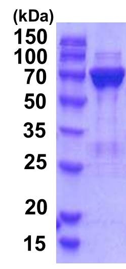 SDS-PAGE - Recombinant Human PGM2 protein (AB201877), expandable thumbnail