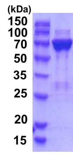 SDS-PAGE - Recombinant Human PGM2 protein (AB201877)