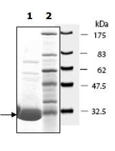 Recombinant human PGP9.5 protein