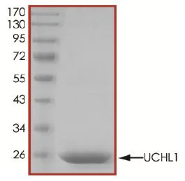 SDS-PAGE - Recombinant human PGP9.5 protein (Active) (AB269110)
