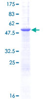 SDS-PAGE - Recombinant Human PGRMC1 protein (AB132523)