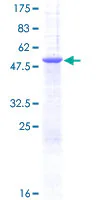 SDS-PAGE - Recombinant Human PGRMC1 protein (GST tag N-Terminus) (AB132523)