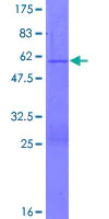 SDS-PAGE - Recombinant Human PGRMC2 protein (AB132526)