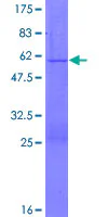 SDS-PAGE - Recombinant Human PGRMC2 protein (GST tag N-Terminus) (AB132526)