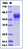 SDS-PAGE - Recombinant Human PGRP1B protein (His tag) (AB276686)