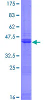 SDS-PAGE - Recombinant Human PH3 protein (GST tag N-Terminus) (AB164181)