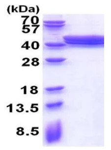 SDS-PAGE - Recombinant Human Phafin-2 protein (His tag N-Terminus) (AB177709)