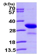 SDS-PAGE - Recombinant Human PHAP1 protein (AB101155)