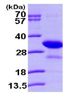 SDS-PAGE - Recombinant Human PHAP1 protein (His tag N-Terminus) (AB101155)