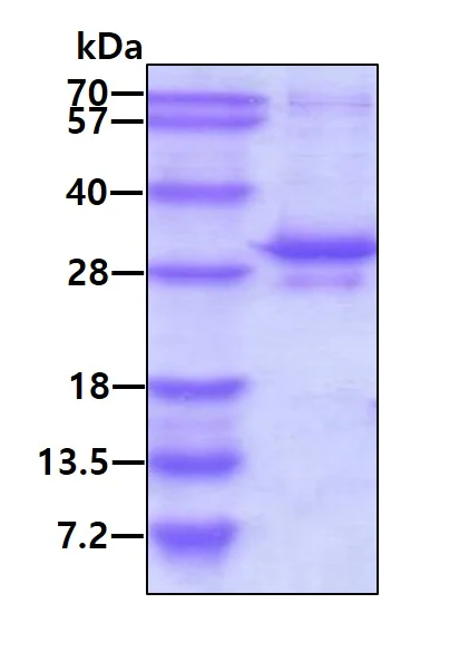 SDS-PAGE - Recombinant Human PHD3 protein (His tag N-Terminus) (AB128449)