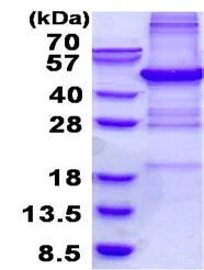 SDS-PAGE - Recombinant Human PHF11 protein (denatured) (His tag N-Terminus) (AB136352)