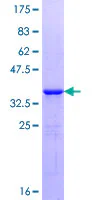 SDS-PAGE - Recombinant Human PHF5A protein (GST tag N-Terminus) (AB164670)