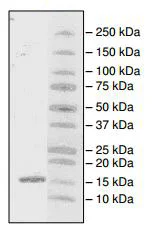 SDS-PAGE - Recombinant Human PHIP protein (His tag N-Terminus) (AB196110)