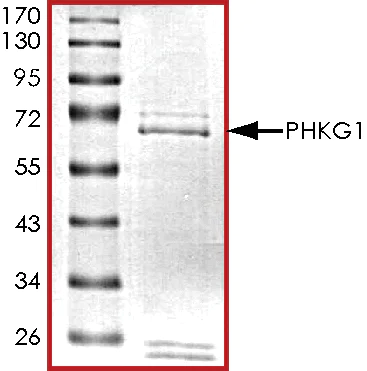 SDS-PAGE - Recombinant human PHKG1 protein (AB101715)