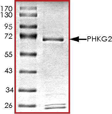 SDS-PAGE - Recombinant human PHKG2 protein (AB89857)