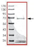SDS-PAGE - Recombinant human PHKG2 protein (AB89857)