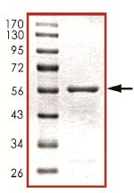 SDS-PAGE - Recombinant Human PHLPP2 protein (AB125556), expandable thumbnail